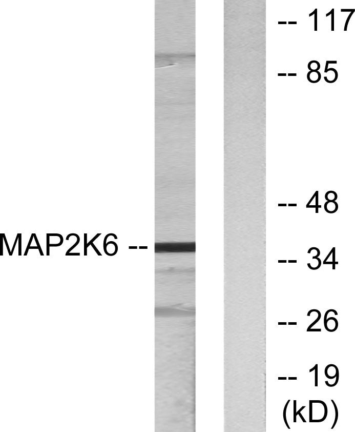 MEK-6 Rabbit Polyclonal Antibody