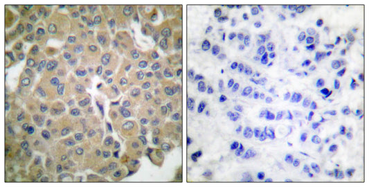 Melan-A Rabbit Polyclonal Antibody