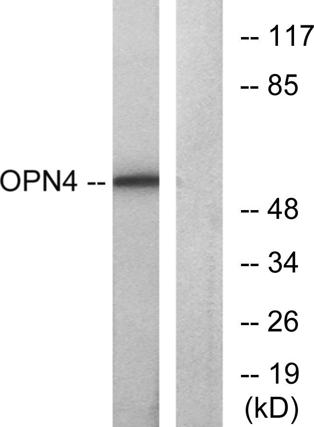 Melanopsin Rabbit Polyclonal Antibody