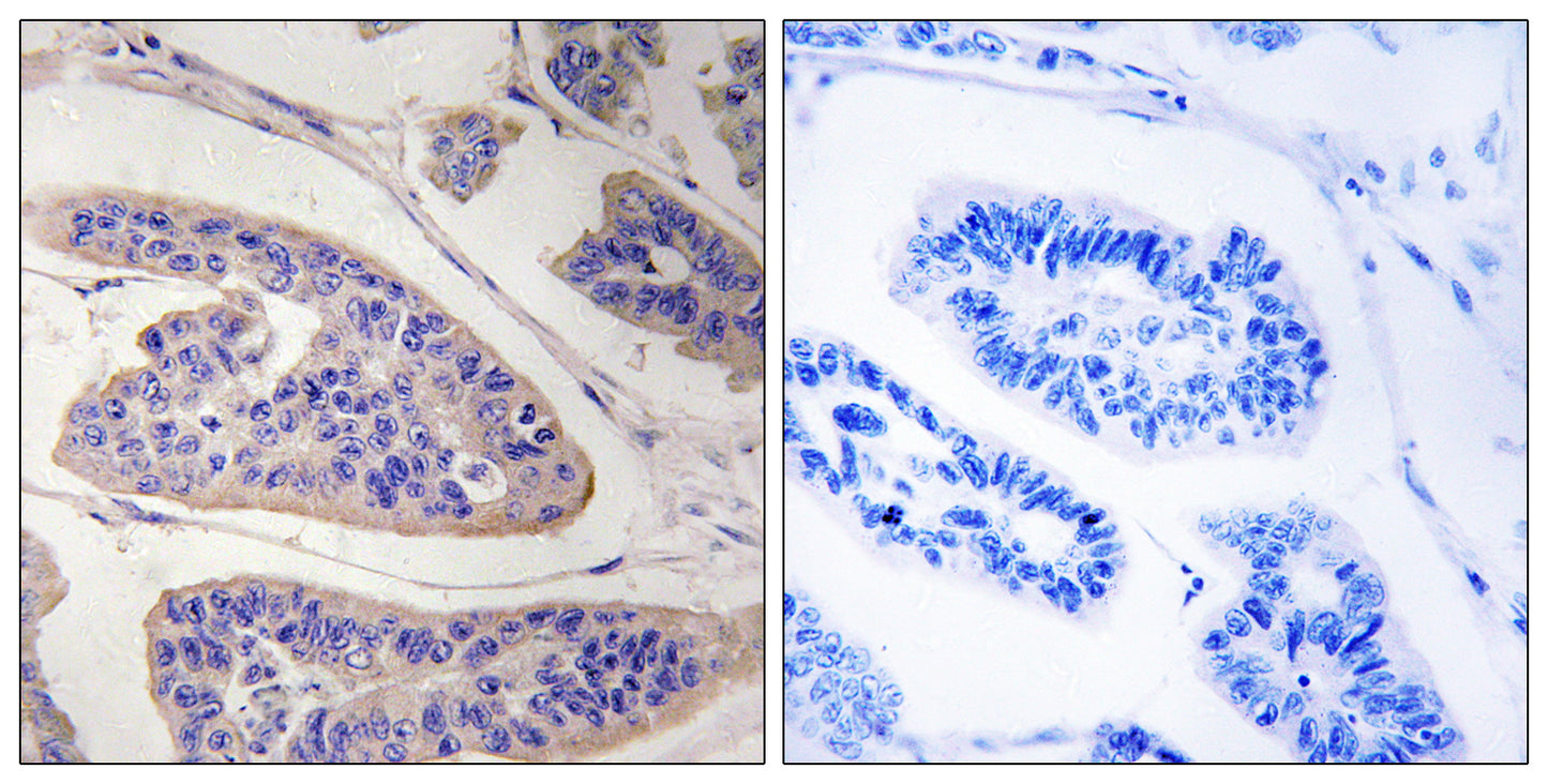 Mena Rabbit Polyclonal Antibody