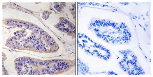 Mena Rabbit Polyclonal Antibody