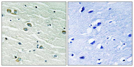 MerTK/Tyro3 Rabbit Polyclonal Antibody