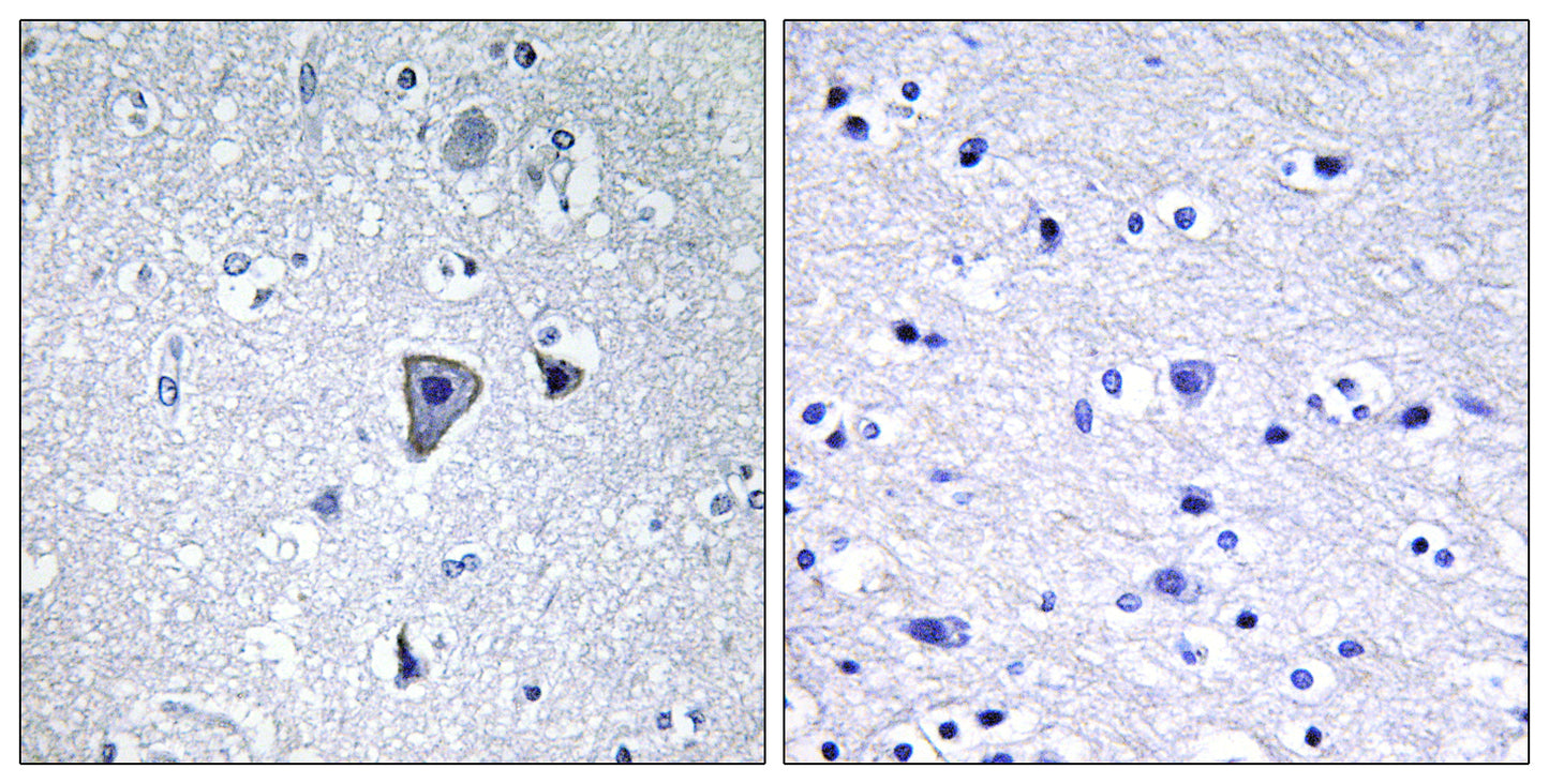 mGluR1 Rabbit Polyclonal Antibody