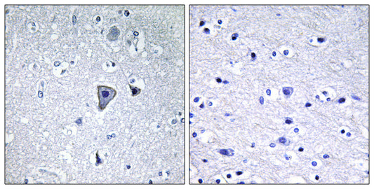mGluR1 Rabbit Polyclonal Antibody