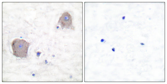 mGluR-4 Rabbit Polyclonal Antibody