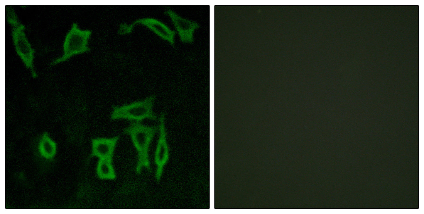 mGluR5 Rabbit Polyclonal Antibody