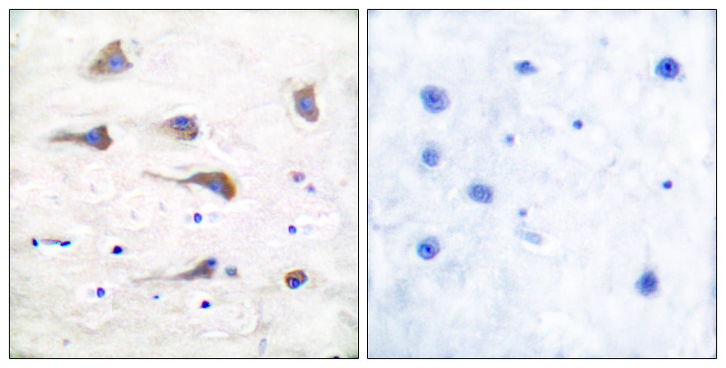mGluR-6 Rabbit Polyclonal Antibody