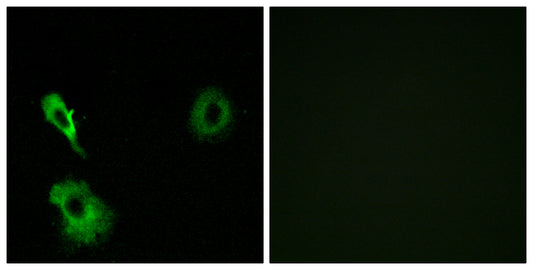mGluR7 Rabbit Polyclonal Antibody