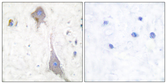 mGluR-7 Rabbit Polyclonal Antibody