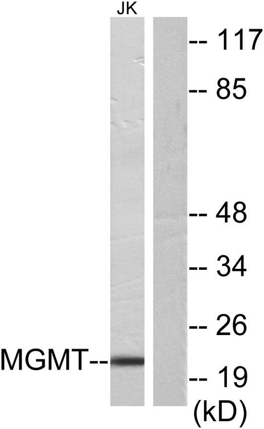 MGMT Rabbit Polyclonal Antibody