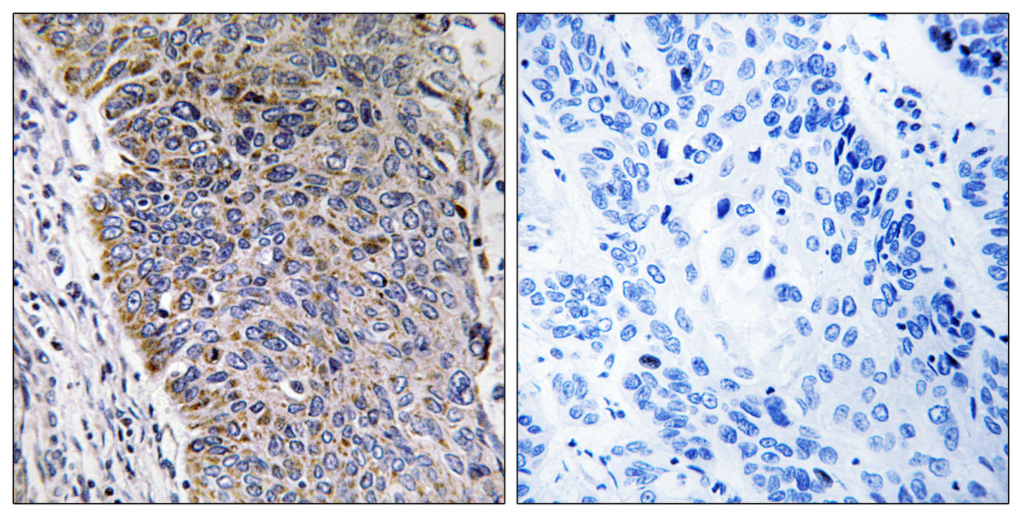 MGST3 Rabbit Polyclonal Antibody