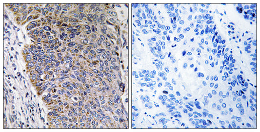 MGST3 Rabbit Polyclonal Antibody
