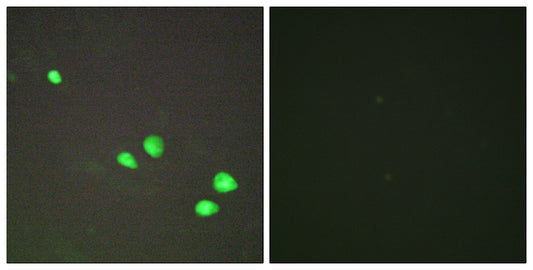 Mi2-β Rabbit Polyclonal Antibody