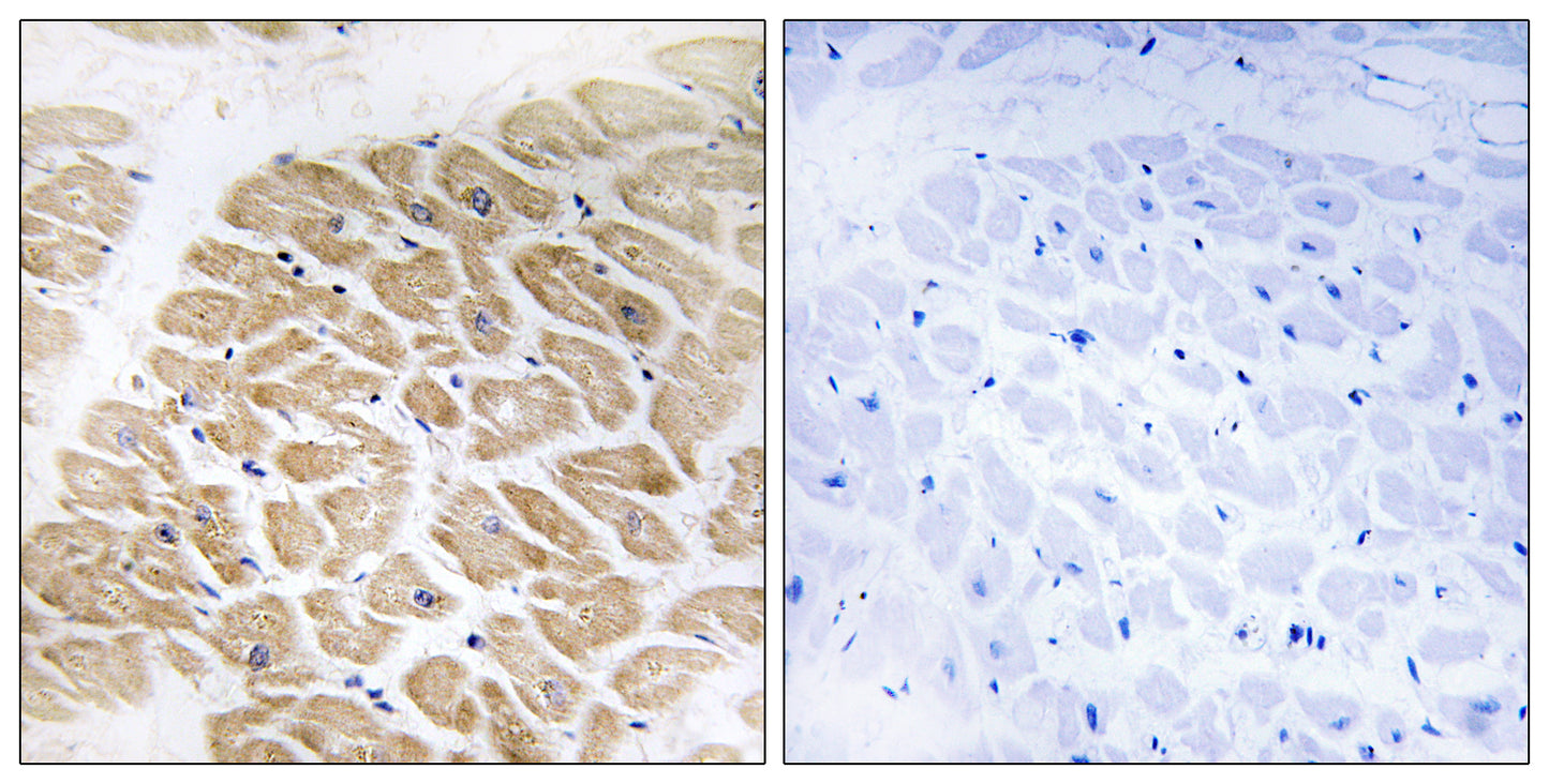 MIA Rabbit Polyclonal Antibody