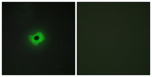 MIC2 Rabbit Polyclonal Antibody