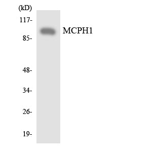 Microcephalin Rabbit Polyclonal Antibody