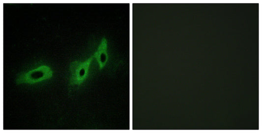 Midline-1 Rabbit Polyclonal Antibody