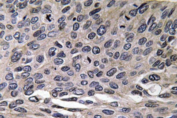MIP-1α Rabbit Polyclonal Antibody