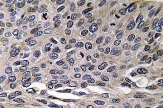 MIP-1α Rabbit Polyclonal Antibody