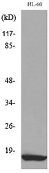 MIP-1β Rabbit Polyclonal Antibody