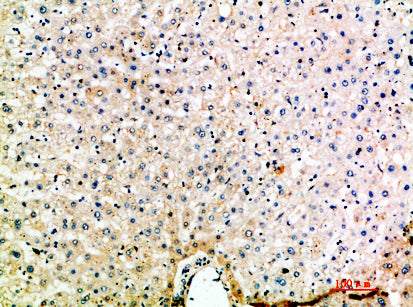 MIP-5 Rabbit Polyclonal Antibody