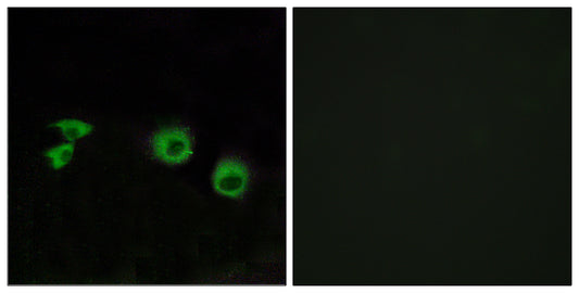 MIP-T3 Rabbit Polyclonal Antibody