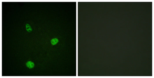 MITF Rabbit Polyclonal Antibody