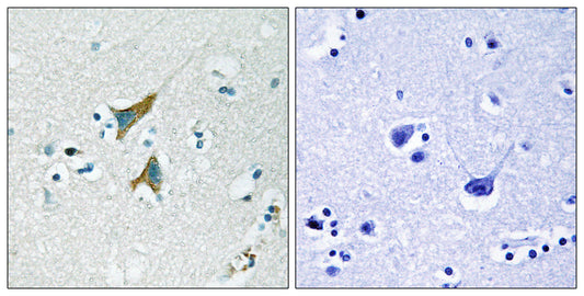 MKP-1 Rabbit Polyclonal Antibody