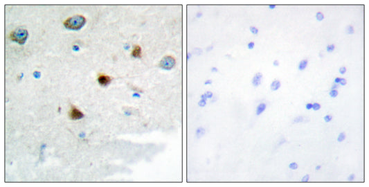 MKP-2 Rabbit Polyclonal Antibody