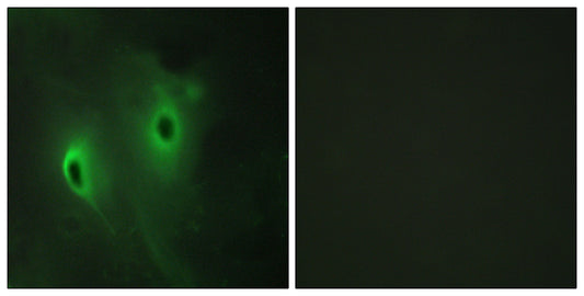 MKP-4 Rabbit Polyclonal Antibody