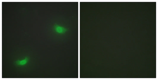 MKP-7 Rabbit Polyclonal Antibody