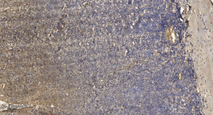 MLC-2 Rabbit Polyclonal Antibody