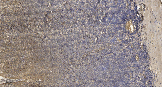 MLC-2 Rabbit Polyclonal Antibody