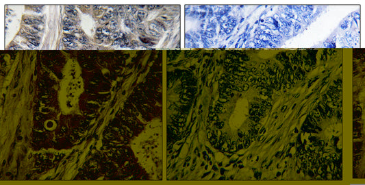 MLK1 Rabbit Polyclonal Antibody