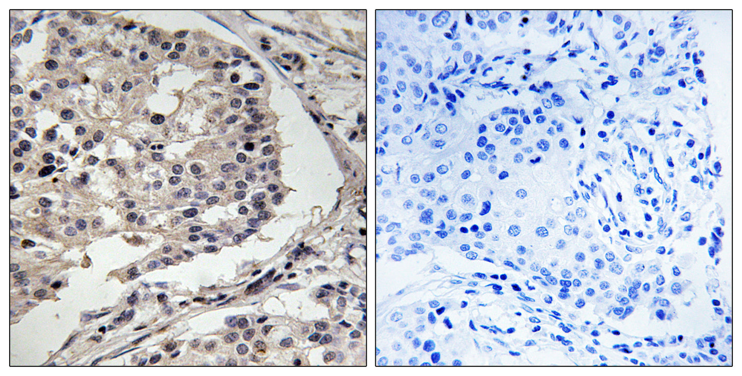 MLK1/2 Rabbit Polyclonal Antibody