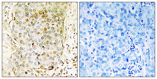 MLK3 Rabbit Polyclonal Antibody