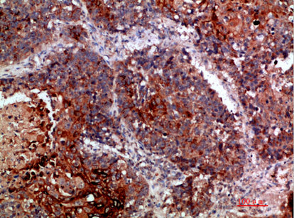 MLL Rabbit Polyclonal Antibody