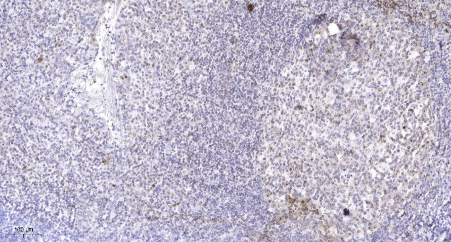 MLL2 Rabbit Polyclonal Antibody