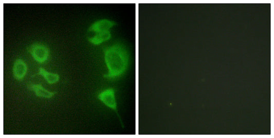 MLTK Rabbit Polyclonal Antibody