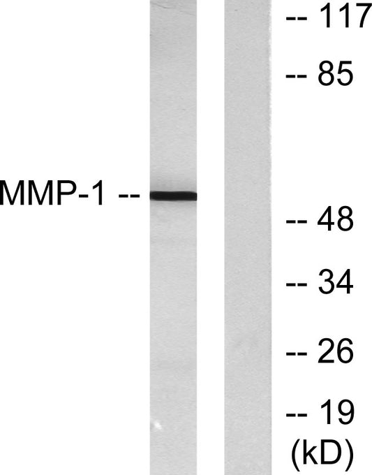 MMP-1 Rabbit Polyclonal Antibody