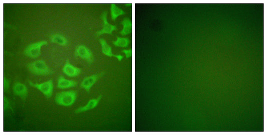 MMP-10 Rabbit Polyclonal Antibody