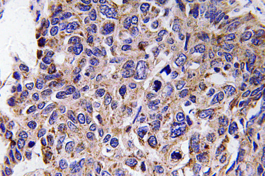 MMP-12 Rabbit Polyclonal Antibody