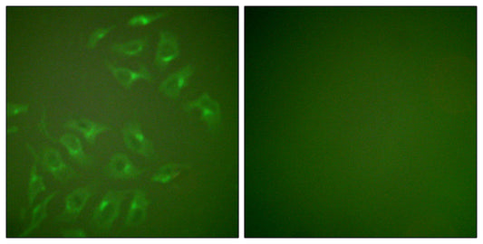 MMP-13 Rabbit Polyclonal Antibody