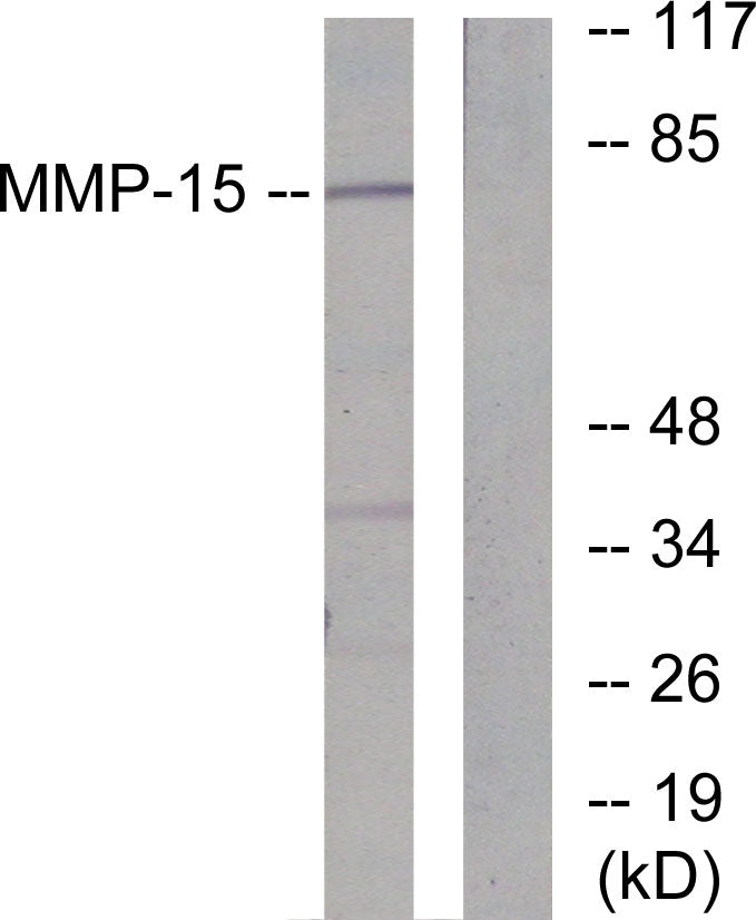 MMP-15 Rabbit Polyclonal Antibody