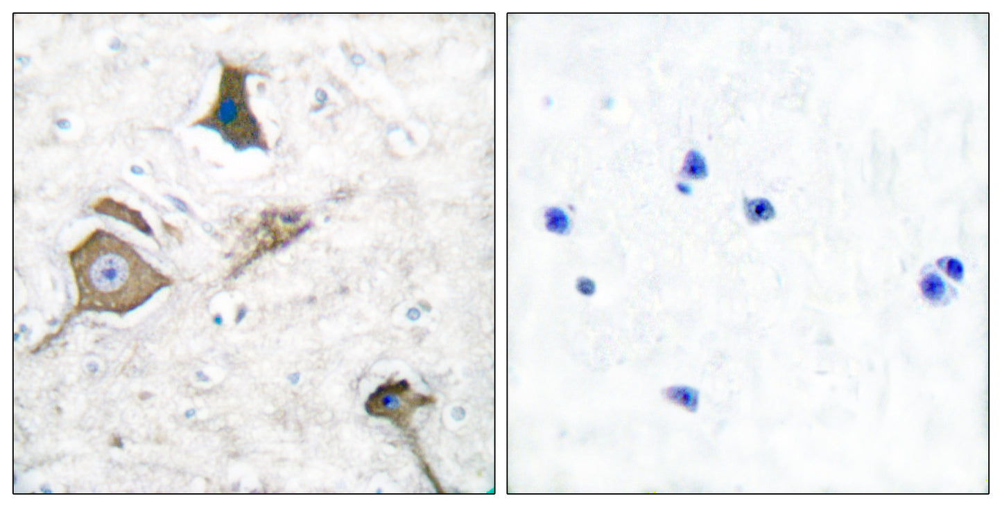 MMP-16 Rabbit Polyclonal Antibody