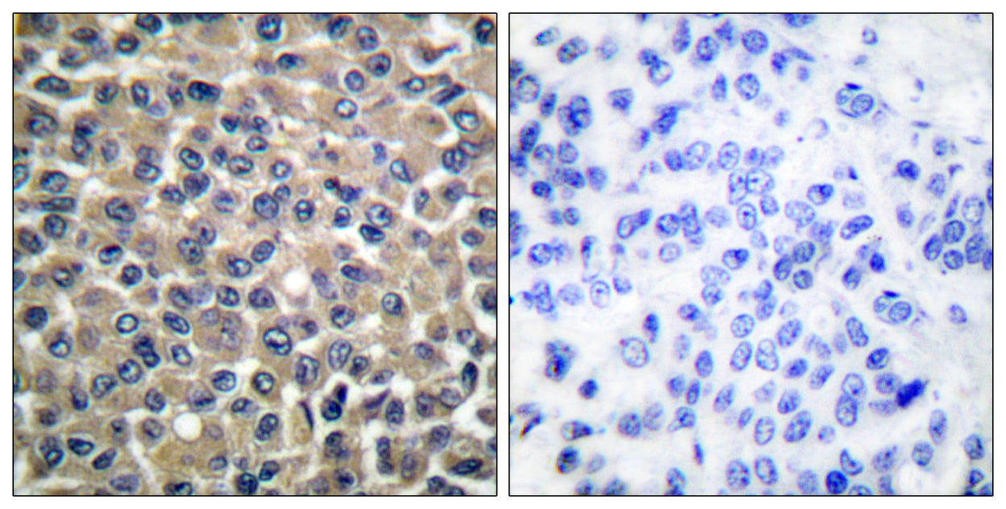 MMP-19 Rabbit Polyclonal Antibody