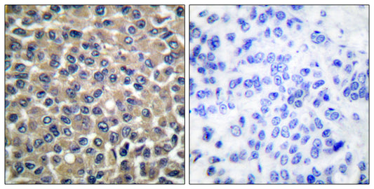 MMP-19 Rabbit Polyclonal Antibody