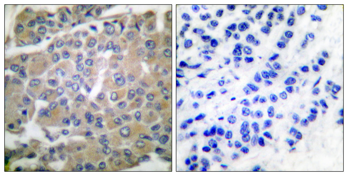 MMP-8 Rabbit Polyclonal Antibody