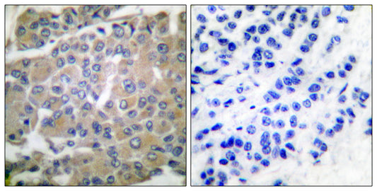 MMP-8 Rabbit Polyclonal Antibody