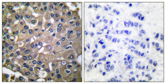 MMP-9 Rabbit Polyclonal Antibody